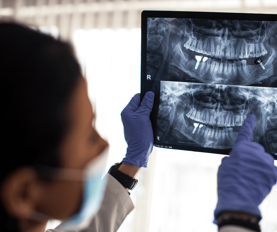Oral Surgery