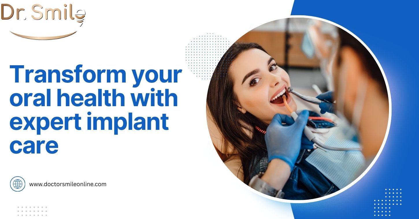 How Dental Implants in San Pedro Can Restore Your Smile & Oral Health?