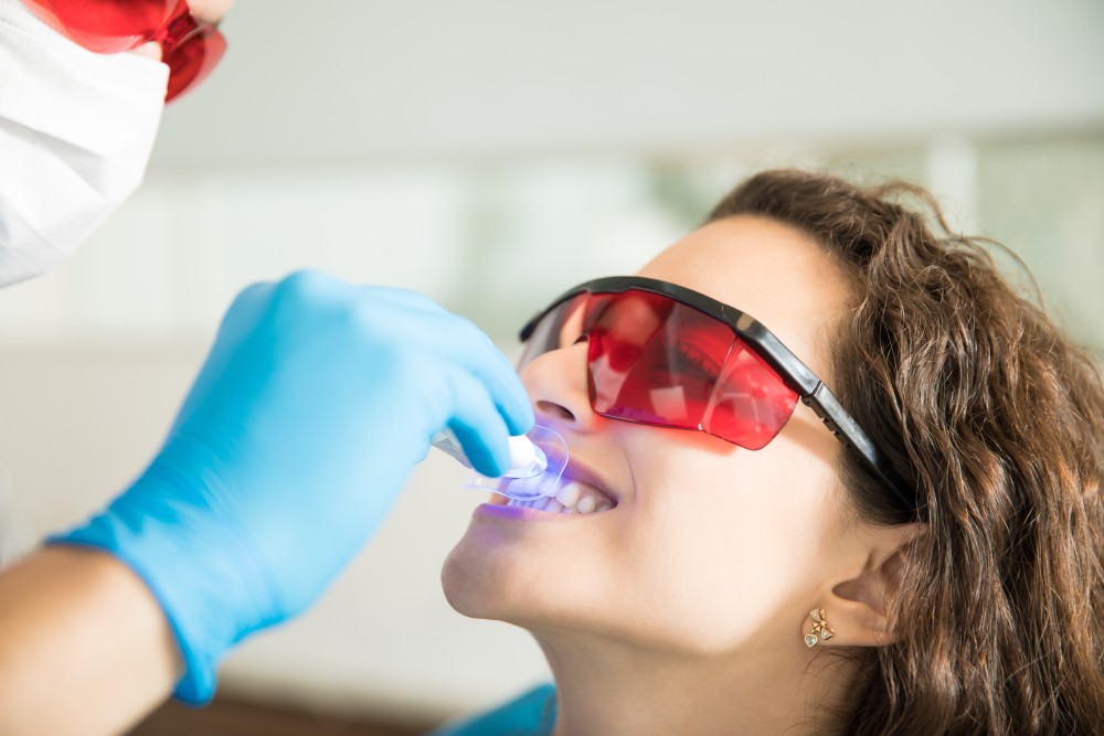 Teeth Whitening Recommendations from a Cosmetic Dentist in Newport Beach