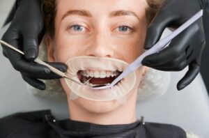 What to expect during a full Mouth Restoration in Lomita: Exploring the ins and outs