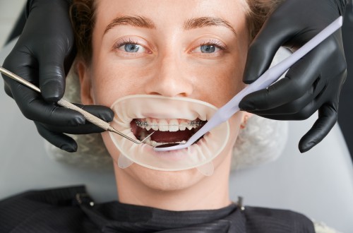 What to expect during a full Mouth Restoration in Lomita: Exploring the ins and outs
